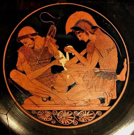 Guerra di Troia - Achille cura una ferita a Patroclo, ceramica a figure rosse del pittore Sosias, 500 a.C. Berlino, Musei Statali