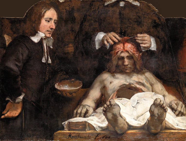 lezione di anatomia del dottor deyman