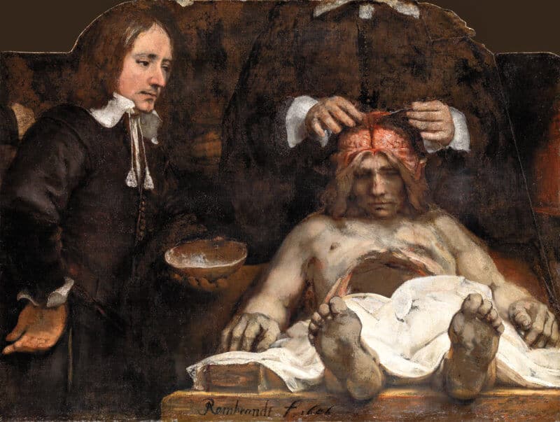 lezione di anatomia del dottor deyman