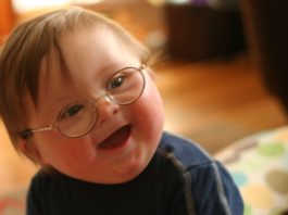 la sindrome di Down: genetico non vuol dire ereditario