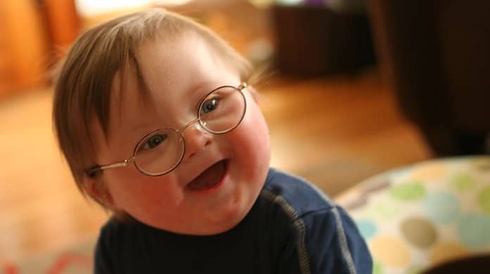 la sindrome di Down: genetico non vuol dire ereditario
