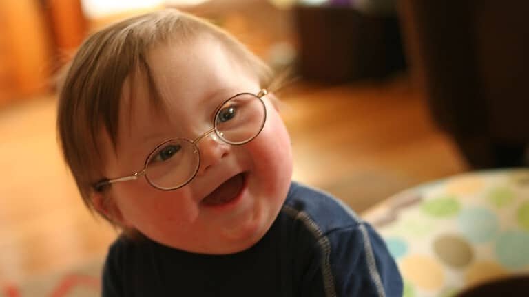 la sindrome di Down: genetico non vuol dire ereditario